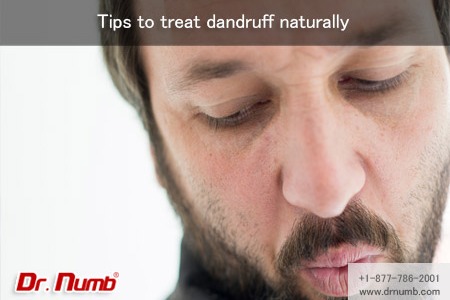 Tips To Treat Dandruff Naturally