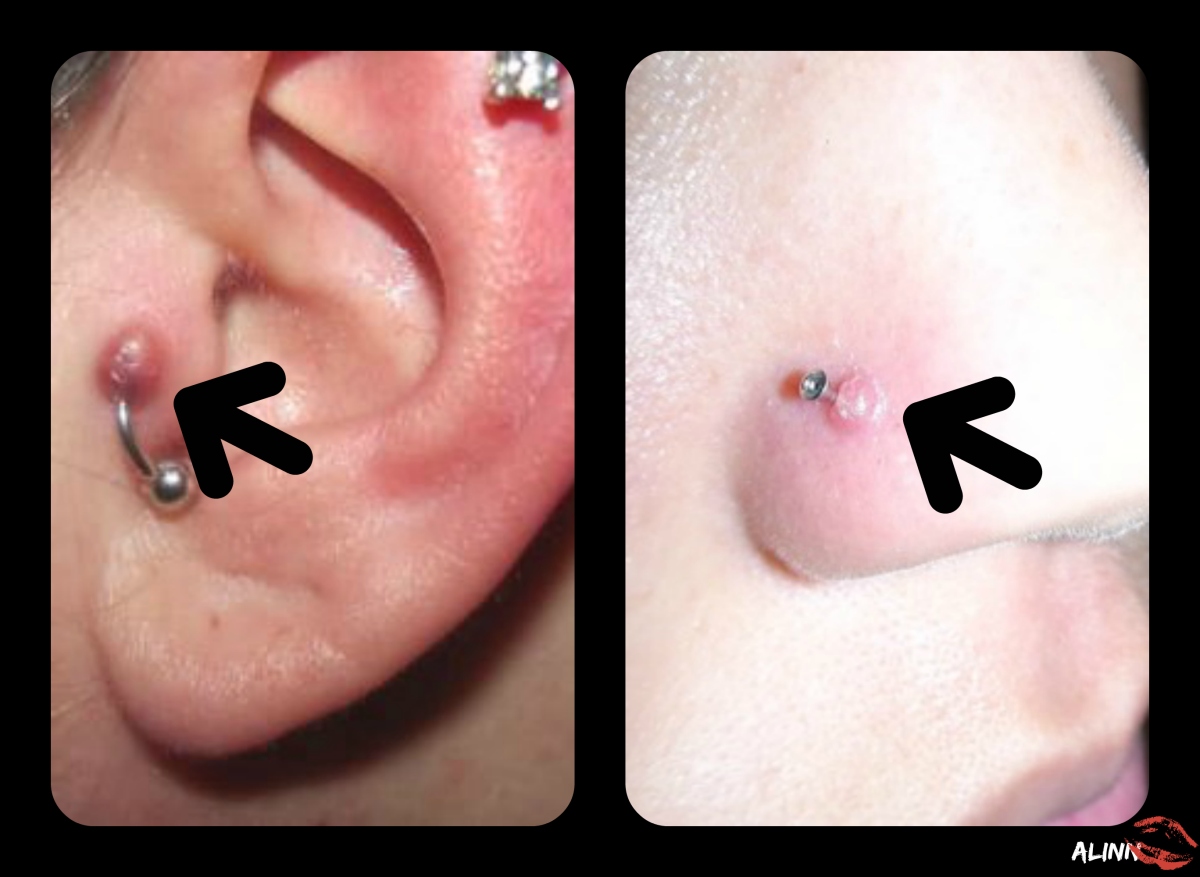Things That Go Bump on Your Piercing – Love to Care Skin